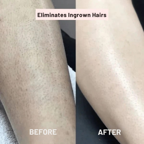 Máquina de afeitar para mujer – Piel suave sin irritación 